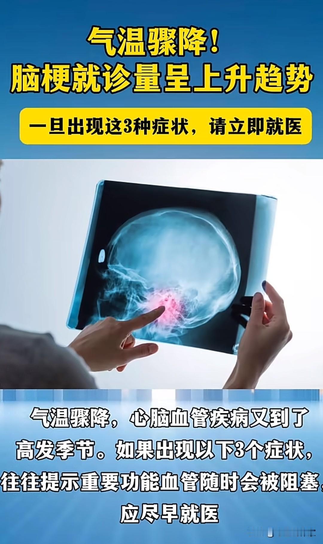 气温骤降，预防脑梗！

最近气温骤降，心脑血管疾病又到了高发季节，一旦出现这三种