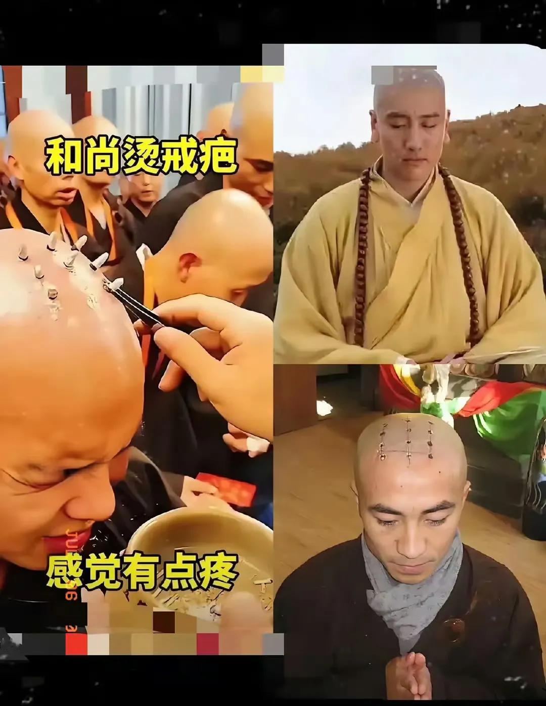 现在有越来越多的人呼吁，应该恢复和尚头上的戒疤。

以前的和尚，人人头上都有戒疤