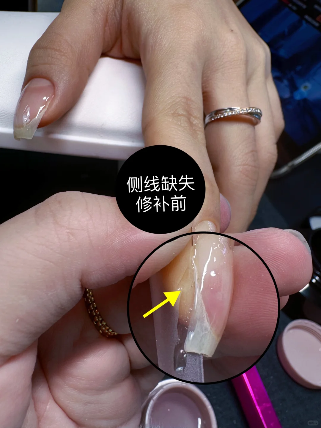 当你的指甲歪歪扭扭侧线缺失