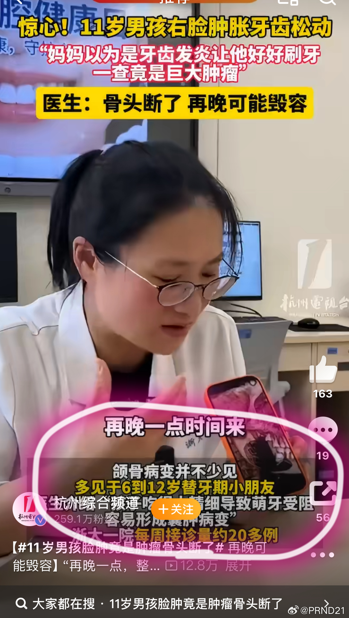 11岁男孩脸肿竟是肿瘤骨头断了 有两件事儿要说：1.图1、2里这个“吃太精细”和