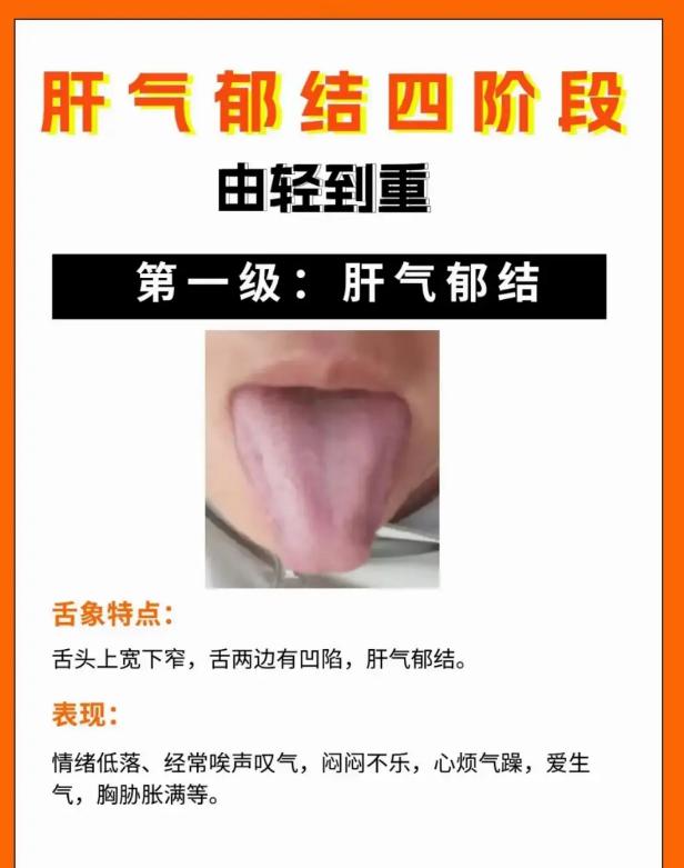 肝气郁结分四阶段，由轻到重一步步加重