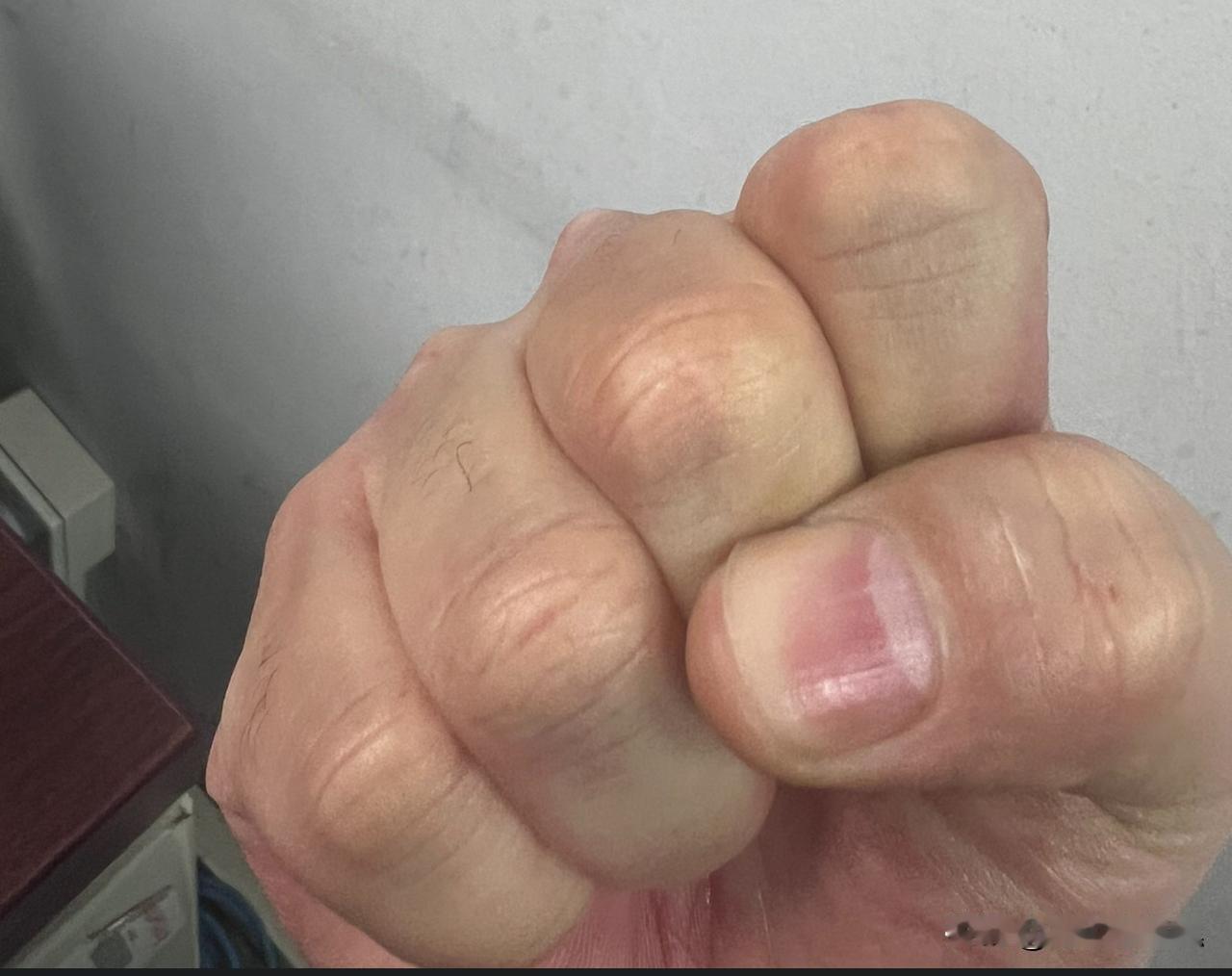 你不用“指节发白”会死吗？

我大约是患上了“强迫症”了。

最近不知什么原因，