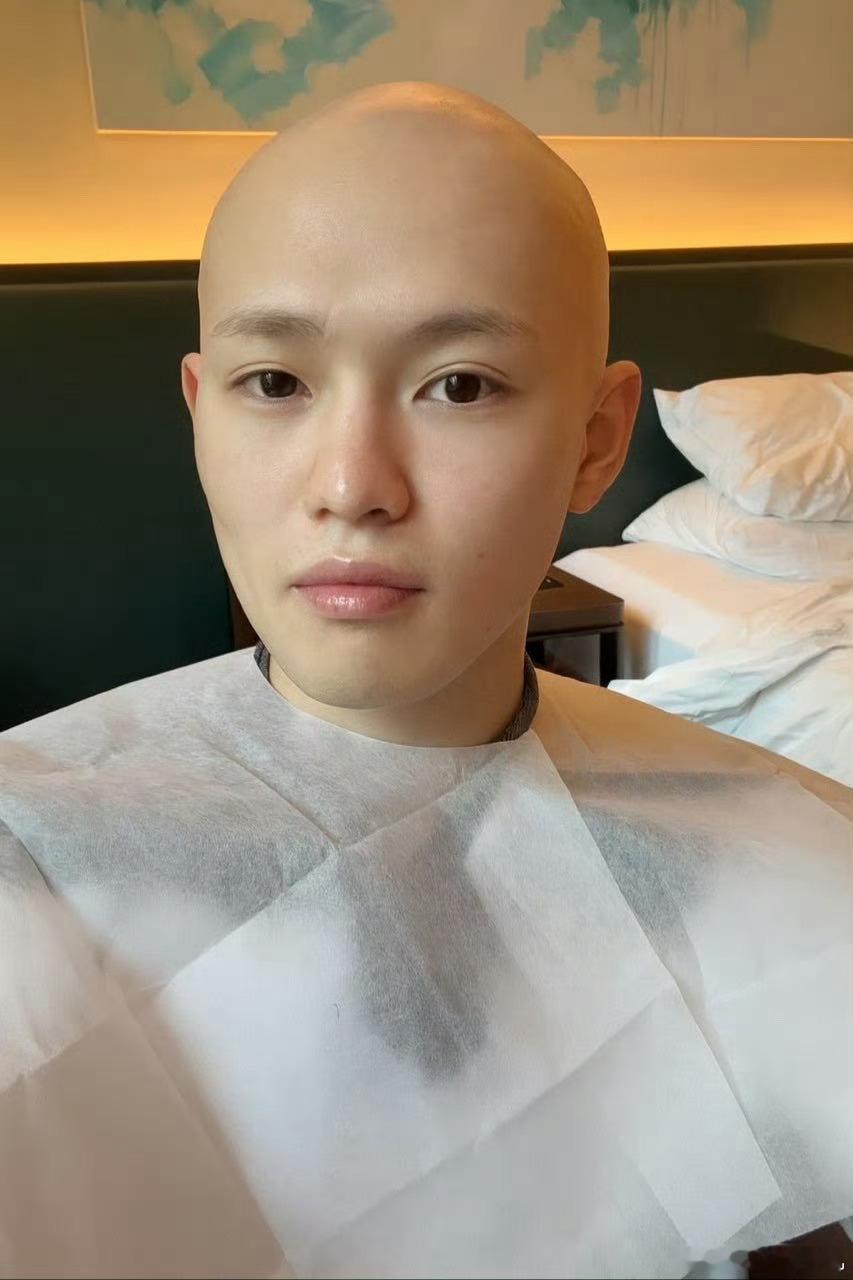 钟辰乐发的自拍 钟辰乐光头 ​​​