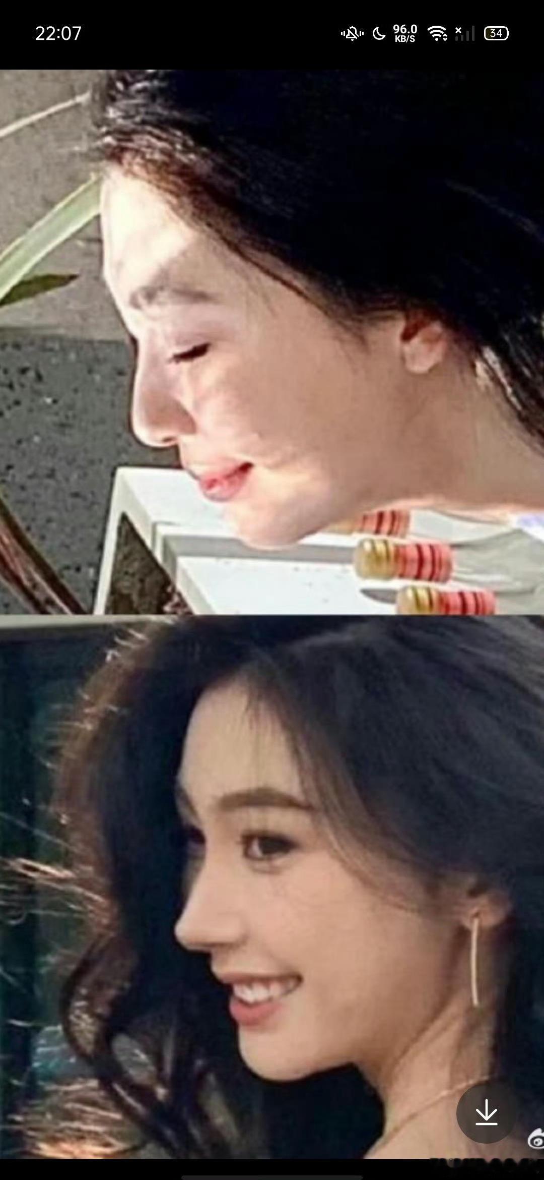 易梦玲这鼻子做的有点失败吧 ​​​