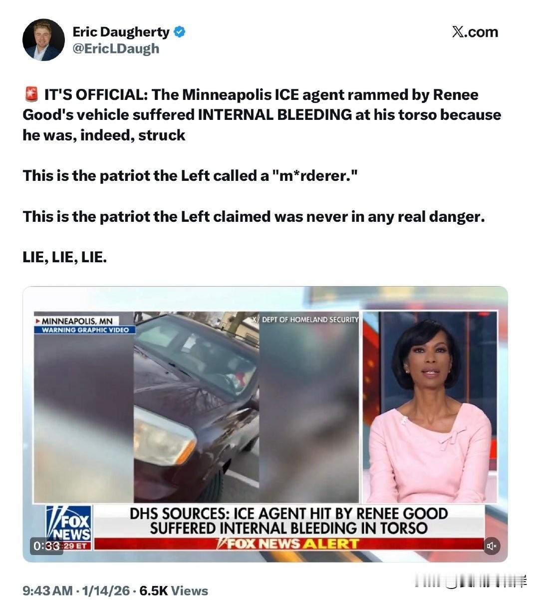 官方确认：在明尼阿波利斯被 Renee Good 的车辆撞击的 ICE 探员确实