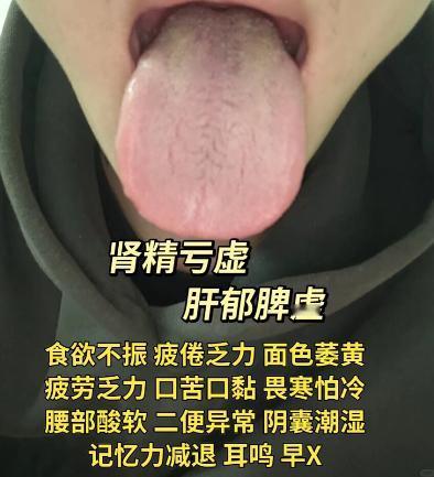 这会有时间，抽空来帮大家继续分析舌象

你越早发，我会越早看！身体小毛病，早发现