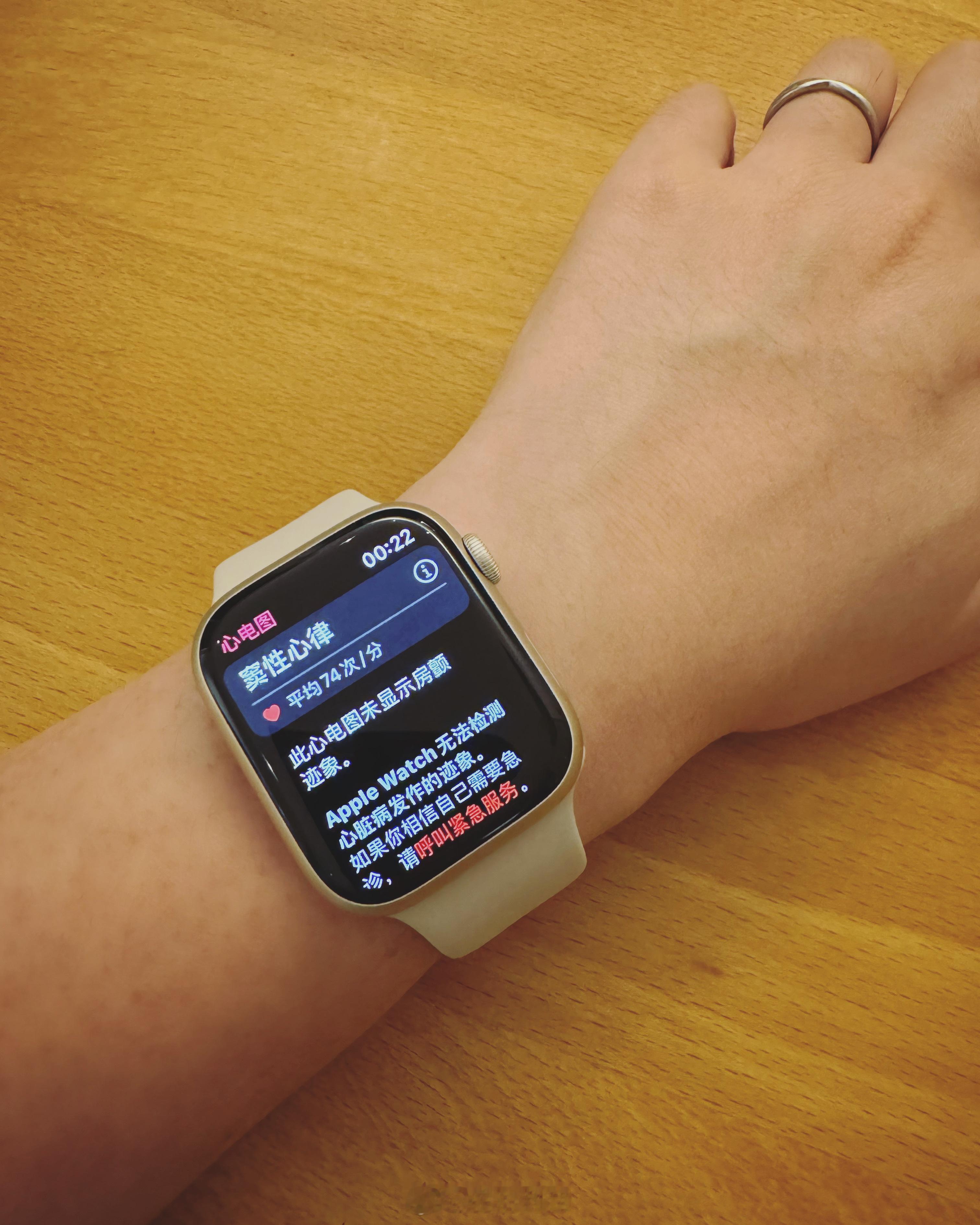 今晚我第一次用了下Apple Watch的心电图功能，还挺新奇的。其实相比于医院