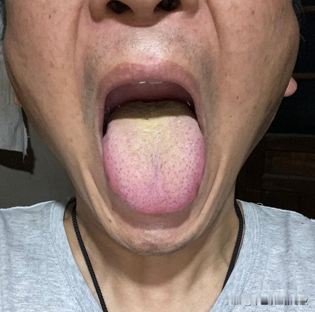 刚过35，看着怎么给个小老头一样呢[捂脸][捂脸][捂脸]
患者主诉：尿频尿急，