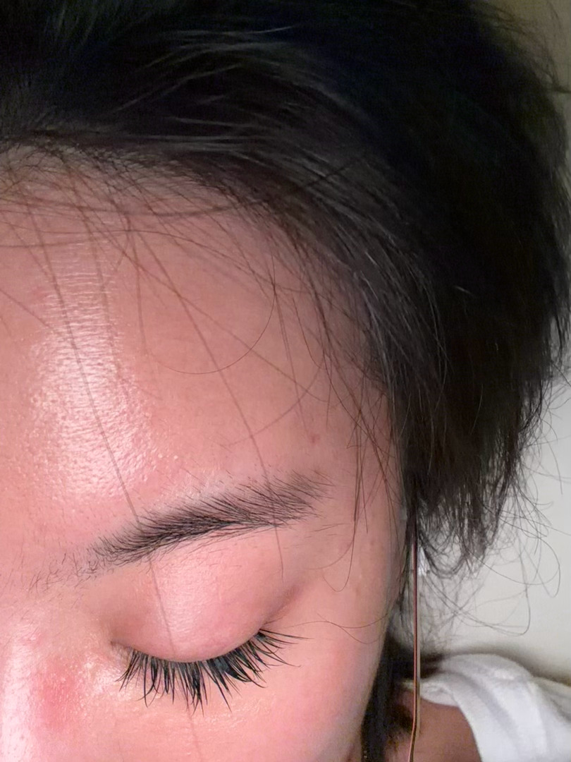 我猜，大家完全看不出来我的眼皮是做的吧？十年前做的，既不是全切，也不是埋线，至今