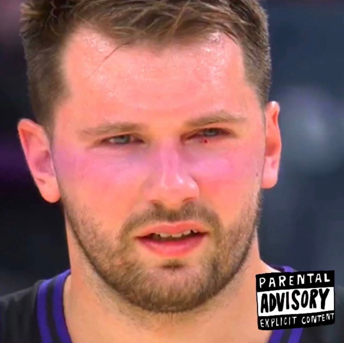 东子眼睛都打出血了。魔术vs湖人洛杉矶湖人