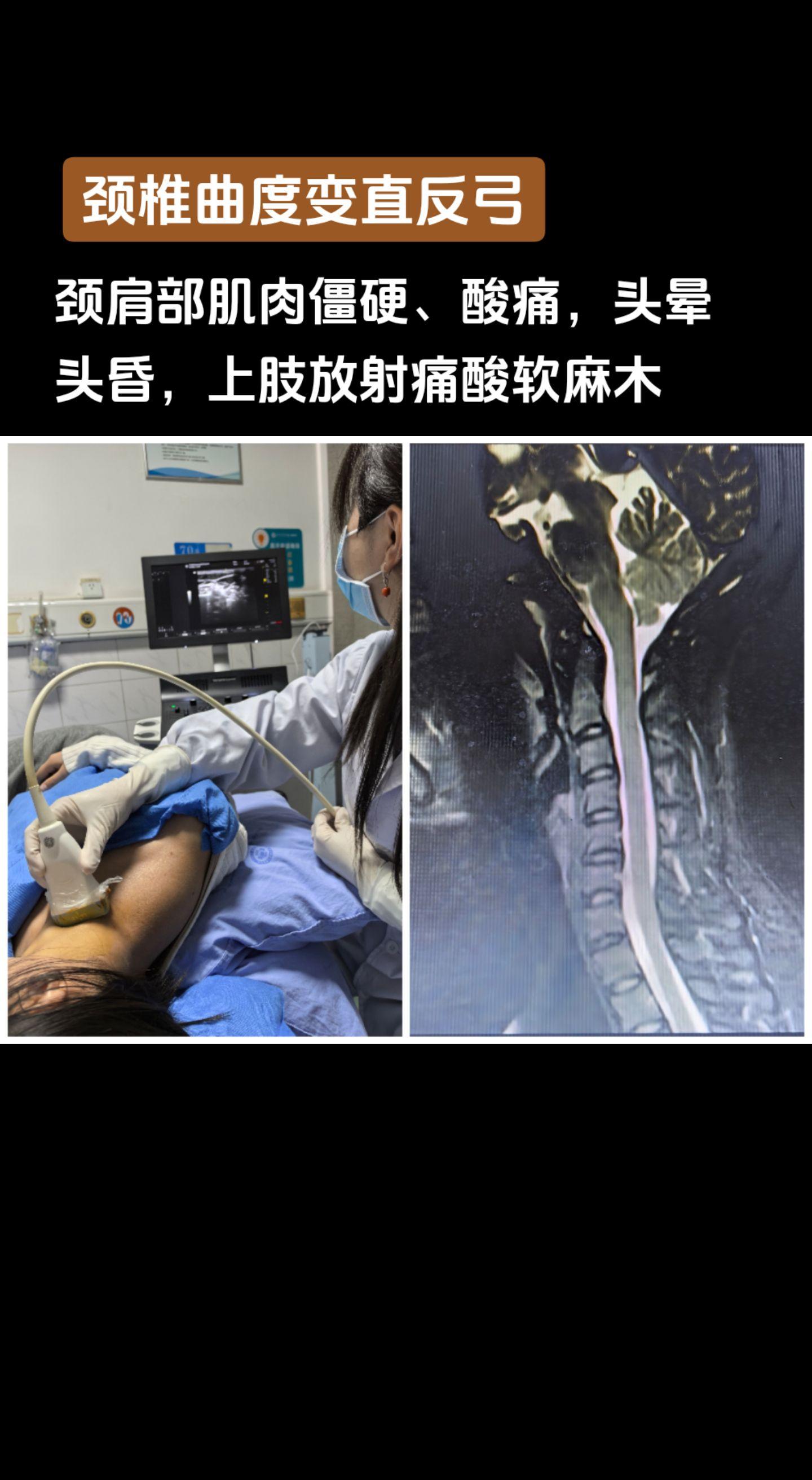 25岁办公室文员真实案例，除了手机，电脑是颈椎第二大杀手。
