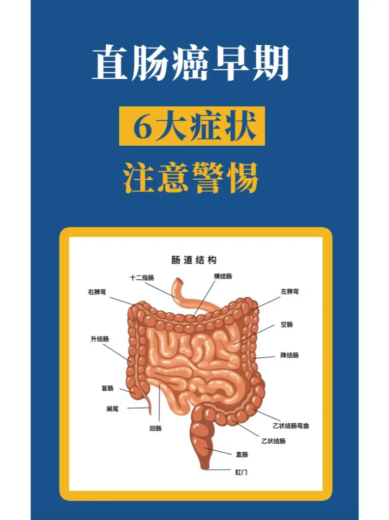 直肠癌早期6大症状和注意事项有哪些？