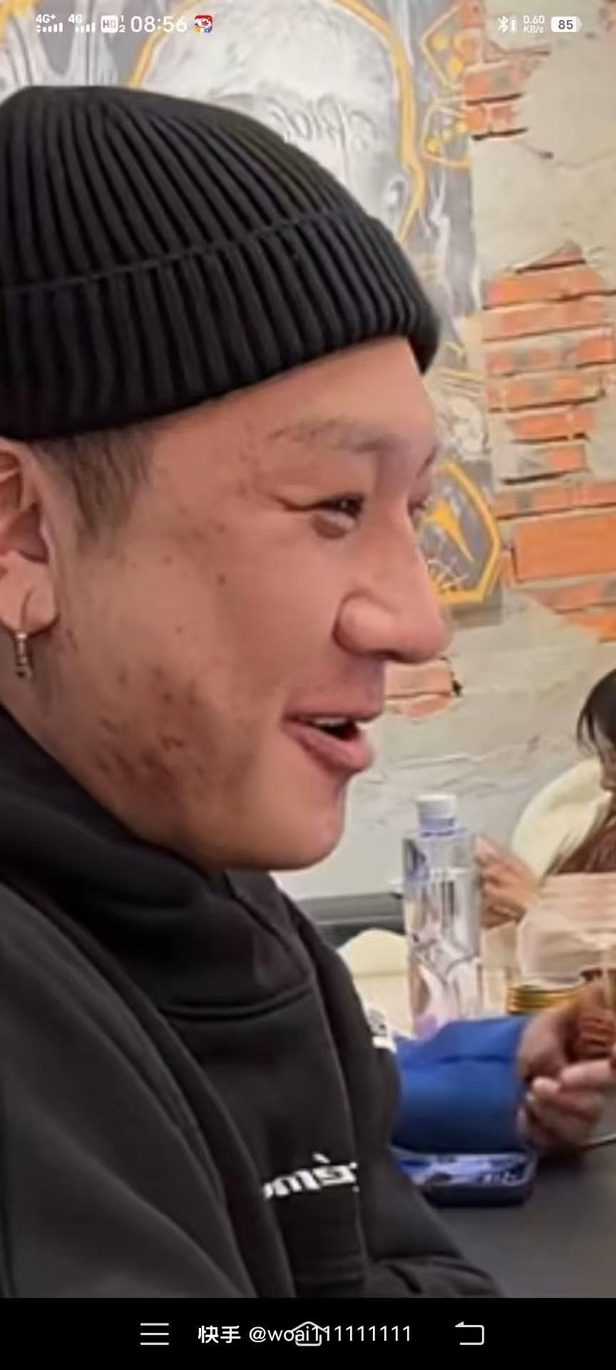 哇哦，方丈的脸咋这样了？