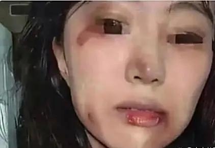 浙江有个吉女士，被老公家暴好多年了，每次都被打得鼻青脸肿的，她打不过老公，想来想