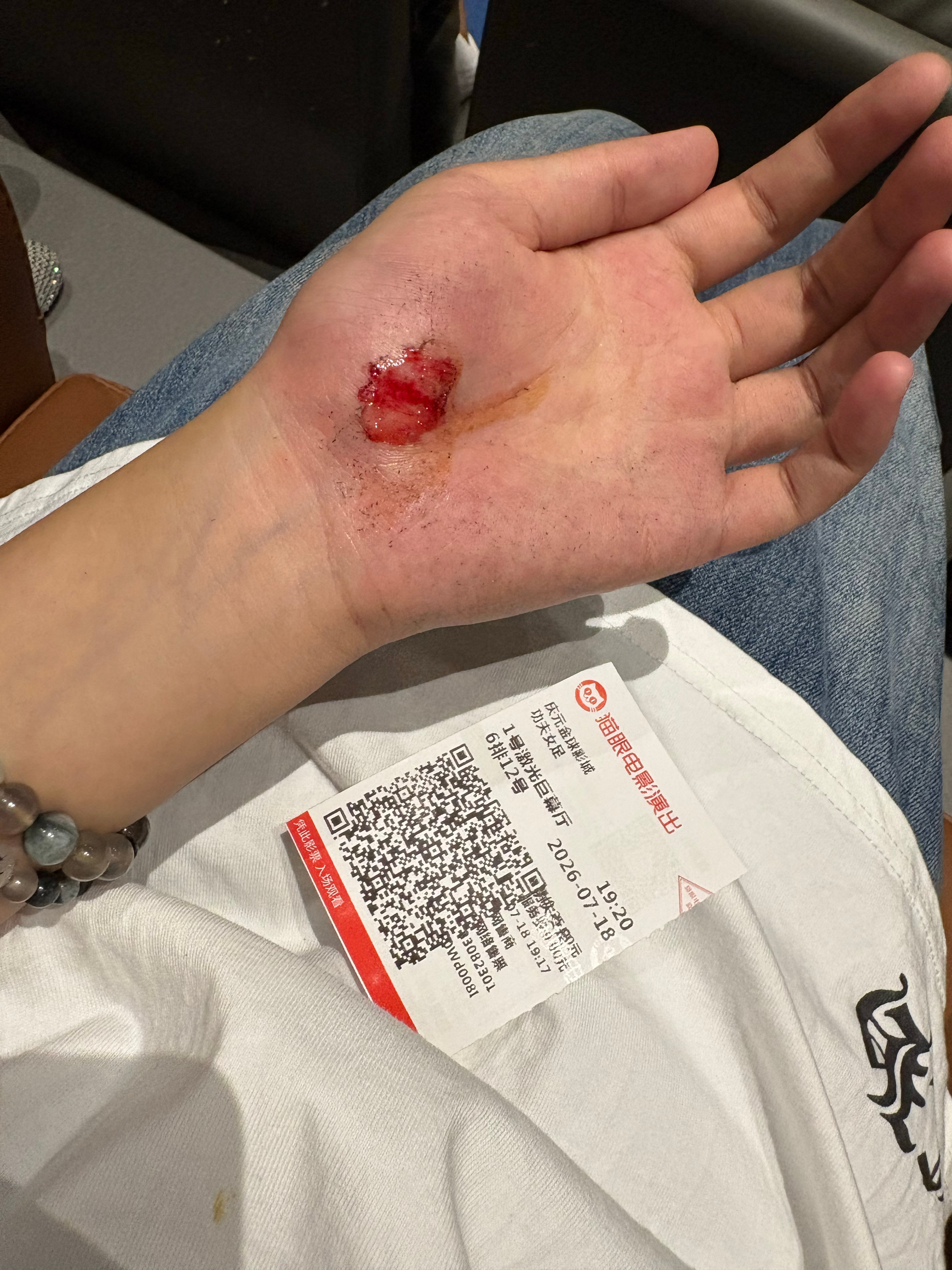 我好痛啊