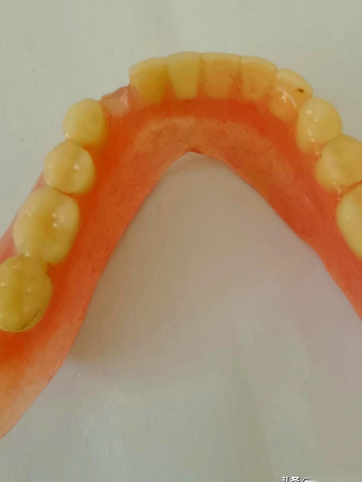 今天真是活久见。
吃个馅饼，软乎乎的那种，结果给我咯掉一颗牙。
我还寻思呢，这馅