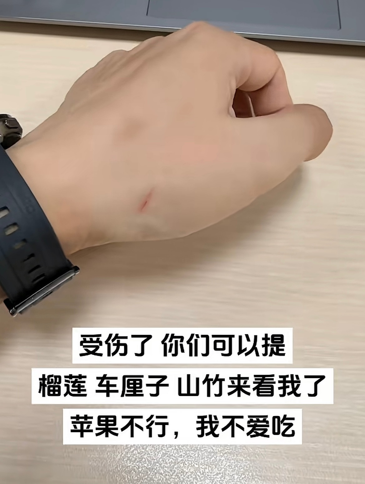晚点伤口就愈合了[手指比心]作者打开评论区天塌了哈哈哈哈哈哈 ​​​