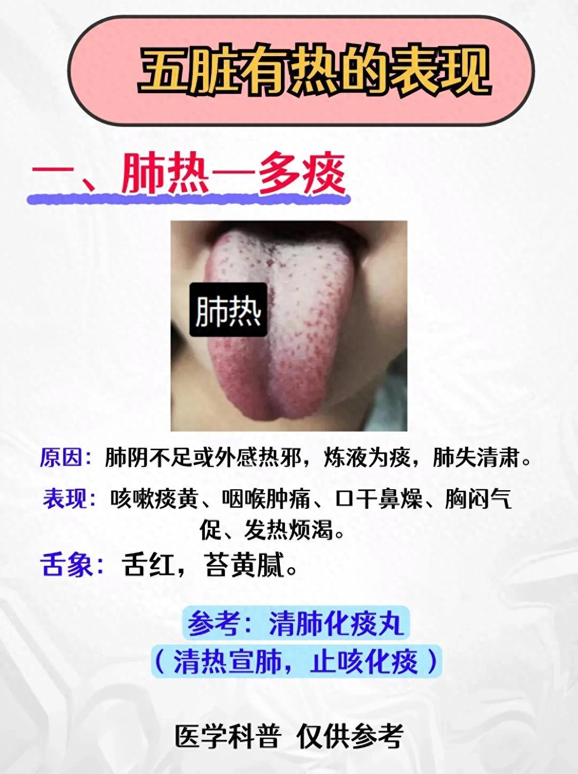必看！五脏有热的5种表现，对照舌象自查！