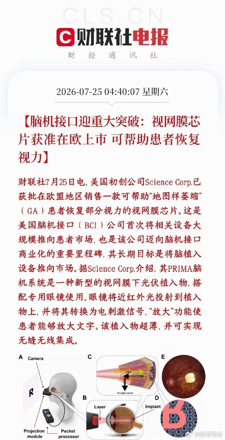 周末，脑机接口传出商用的消息，A股相关概念下周有望反弹美国研发脑机接口设备的企业