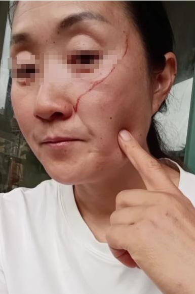 株洲高考母女的母亲，很愚蠢，也不值得同情。 
 
都高考结束了，还要女儿保持高考