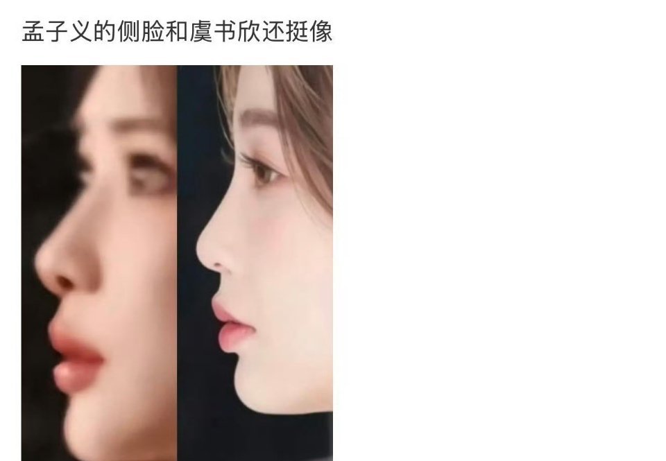 谁侧颜更好看，一下子就能分辨出来吧？虞书欣和孟子义 