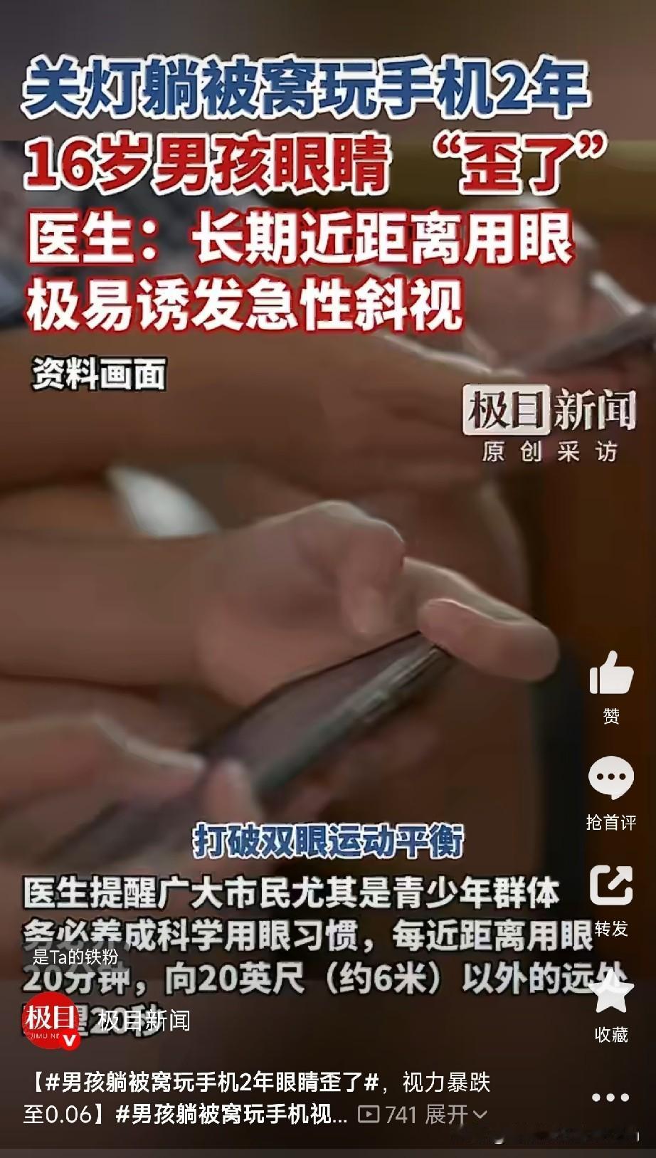 在被窝玩手机的危害太大了

湖北咸宁男孩小曾，两年前右眼开始往内斜，家里人发现了