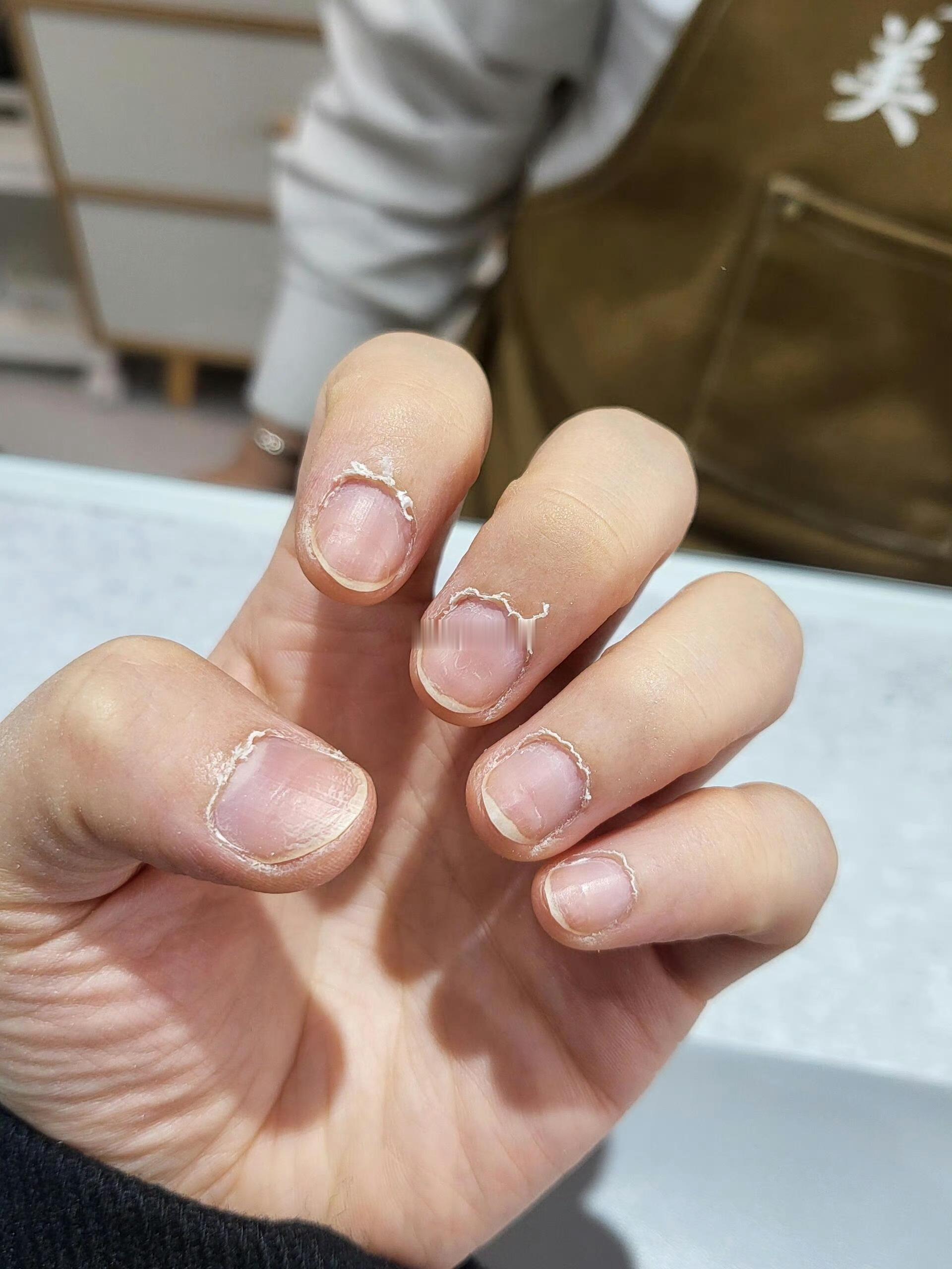女生为了变美也是挺拼的 