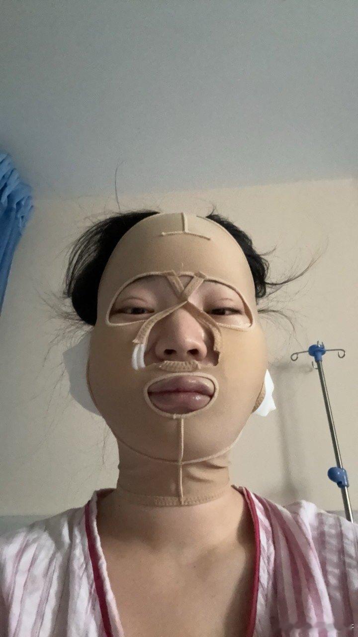 已成猪头 ​​​
