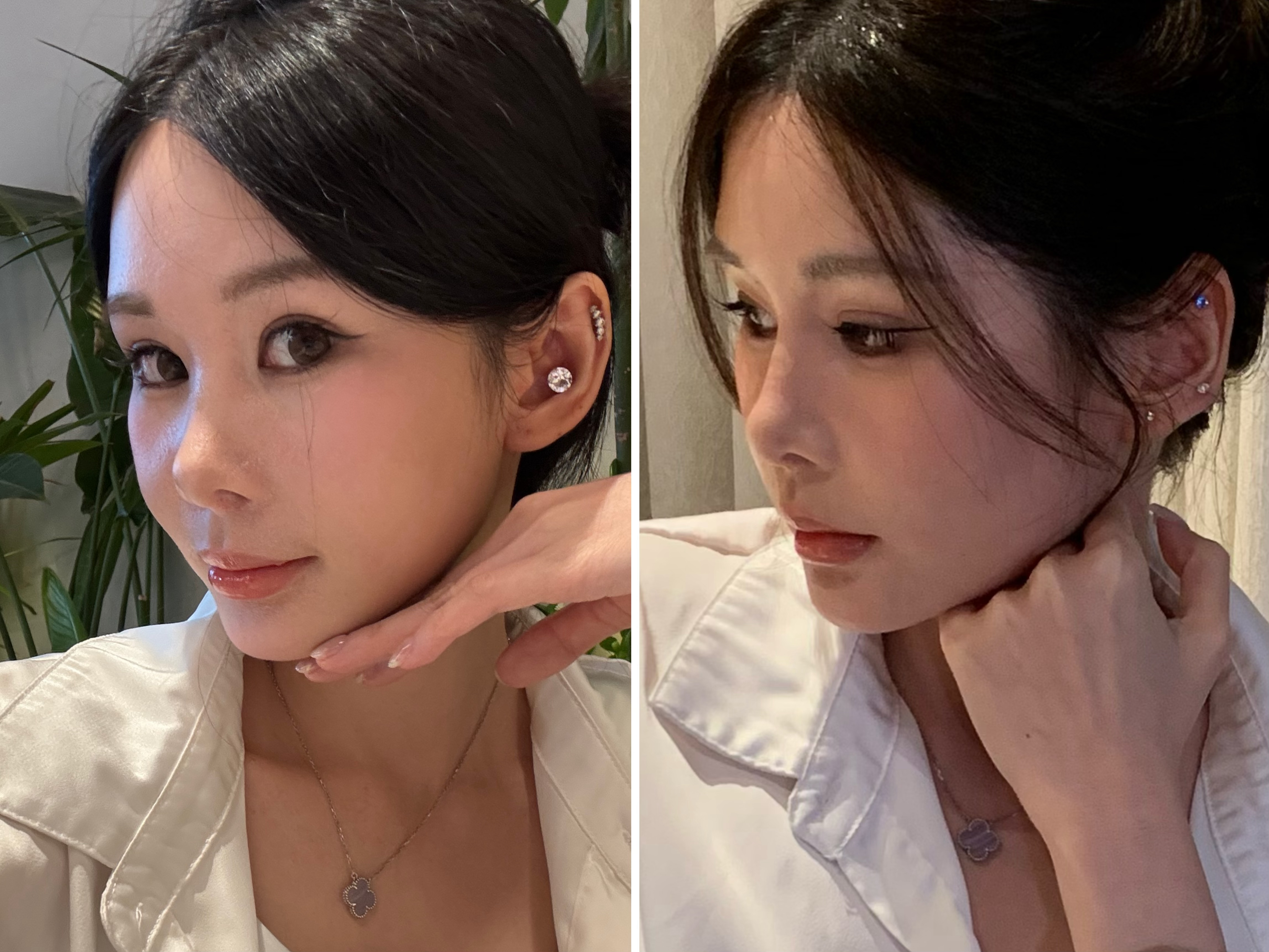 我和我朋友都很感谢黄微，我朋友是严重的油痘皮做了十几次黄微，我是油敏皮做了七八次