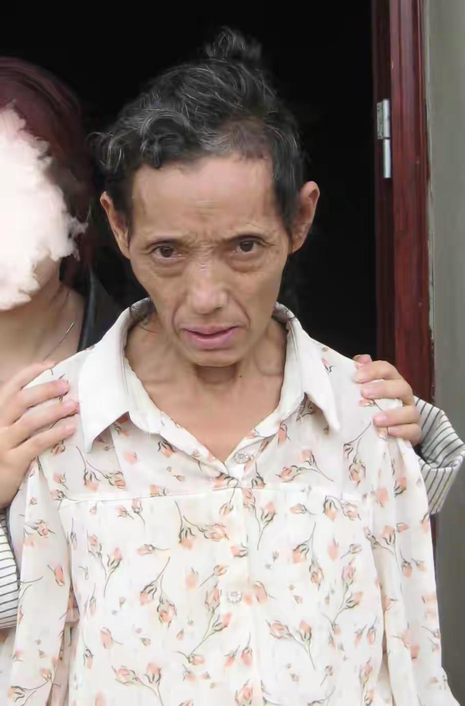 震惊！中年女子在眉山神秘失踪，患精神障碍，家属急寻！你的帮助可能拯救她的生命！