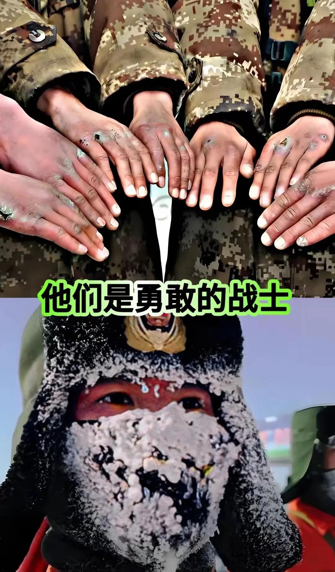 向边防部队的军人致敬！你们辛苦了，受累了，你们的手脚和脸全都冻坏了，伤痕累累，一