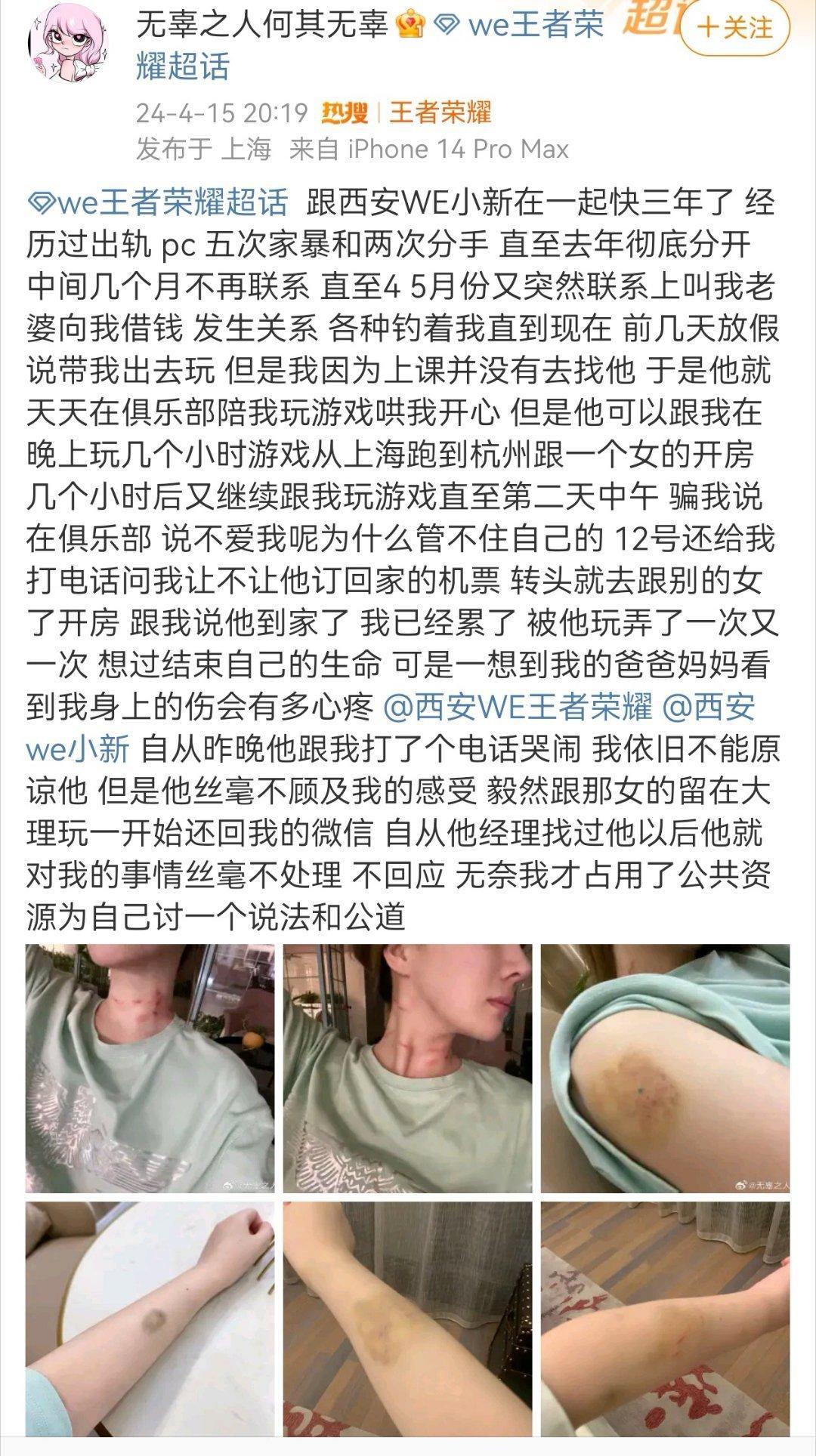 #小新被爆家暴出轨# 零容忍！！！家暴必须受到法律制裁！[怒][怒]刚刚西安WE