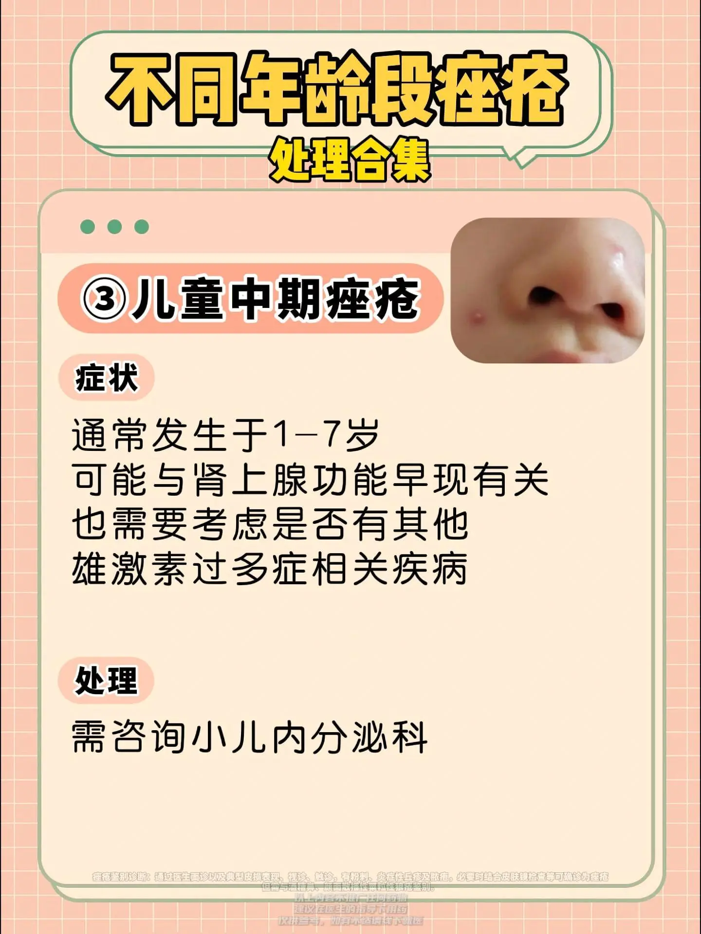 各个年龄段都会长痘！一个合集教你分别处理。