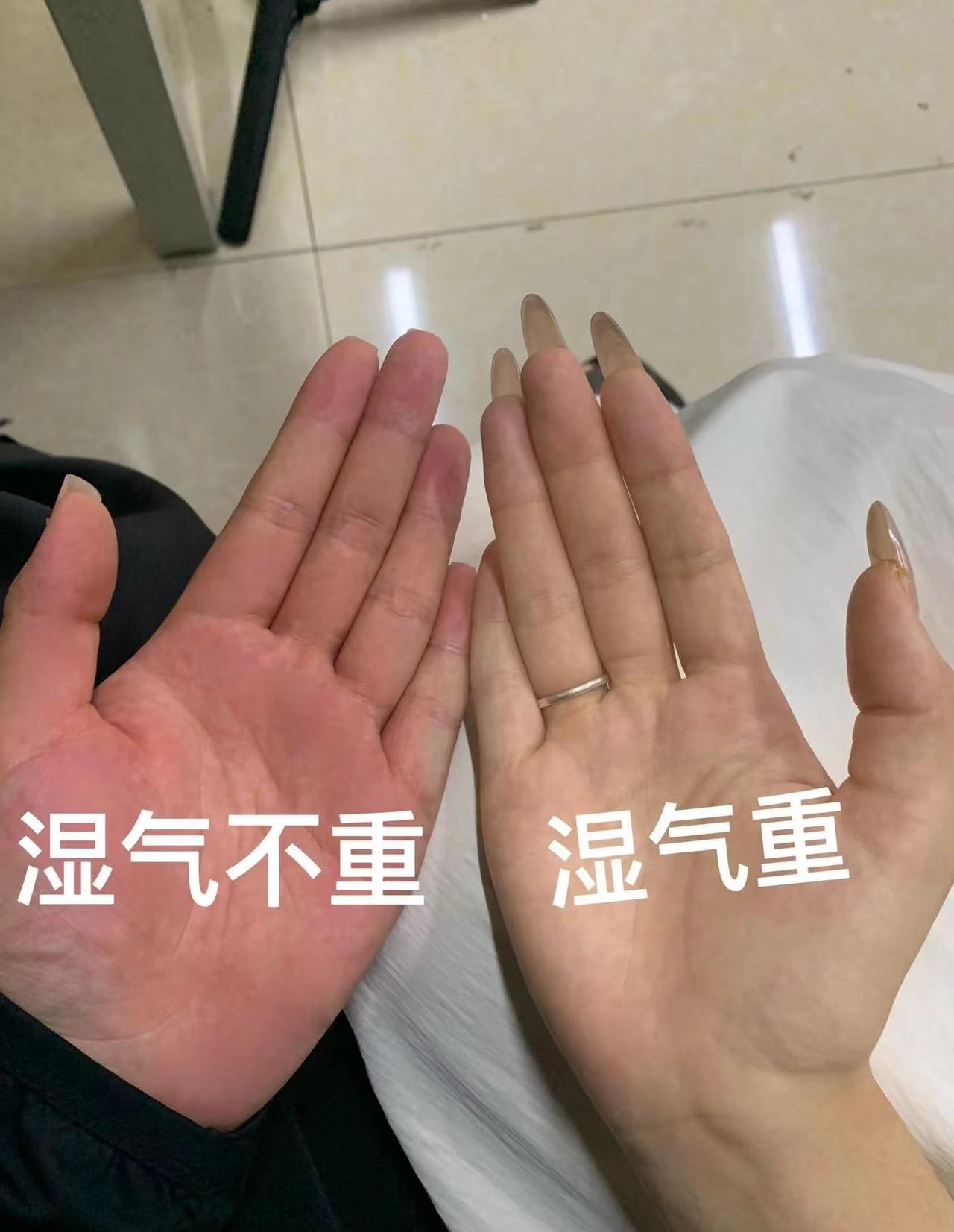 自律一个月，湿气全排空！瘦10斤、脸不油、浑身都轻松！

总瘦不下来？脸爱出油？