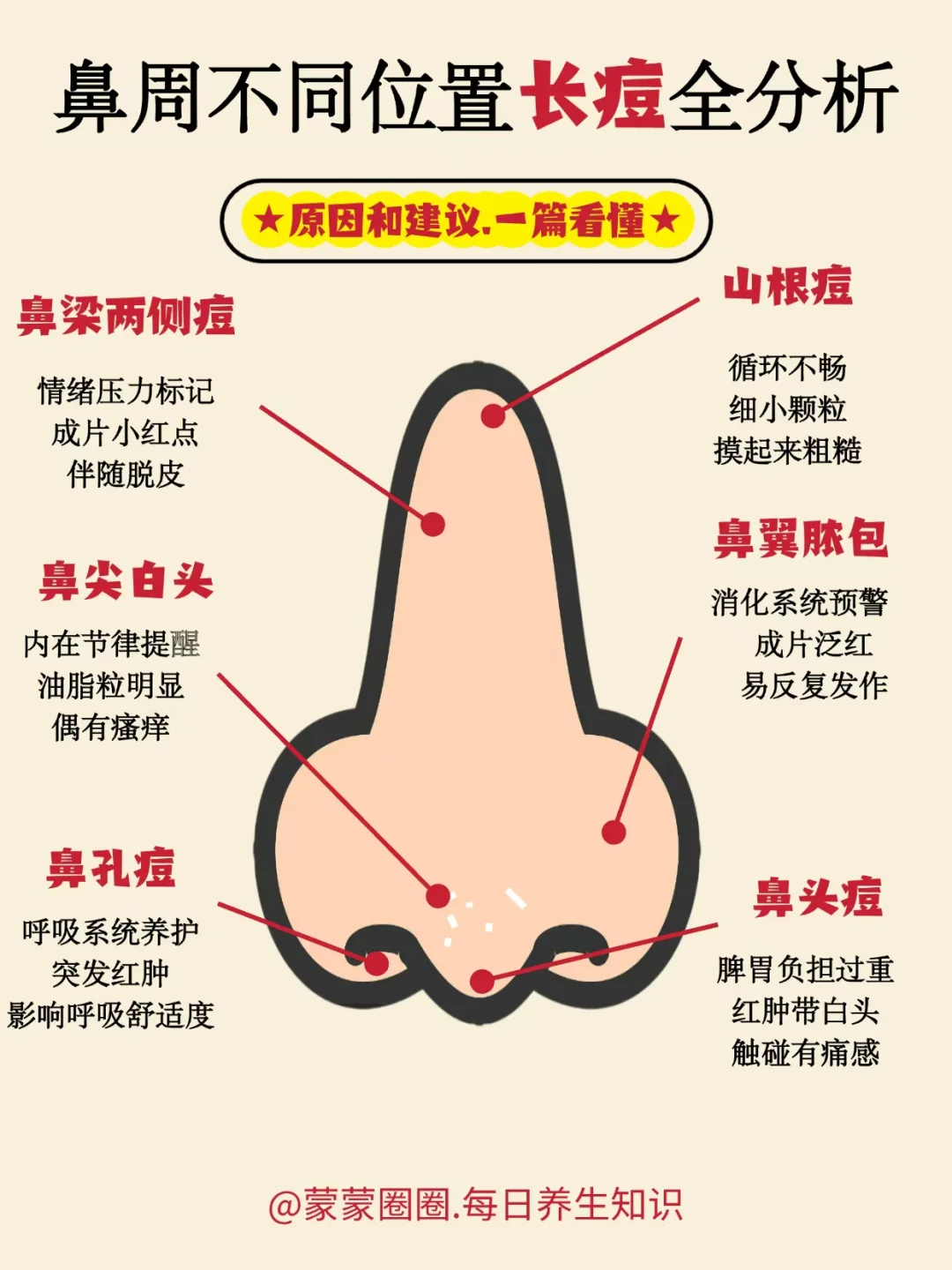 鼻周不同位置长痘全分析