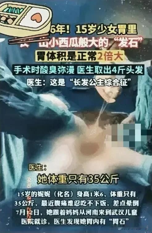 震惊！
河南一女孩因腹痛吃不下饭，去医院看病，不料，医生竟从她的胃里，发现一颗堪