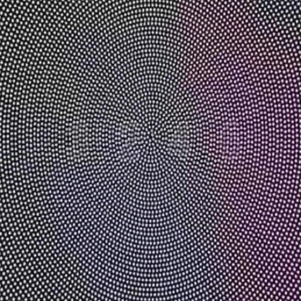 你的眼睛还好吗？3246：散光+近视3240：散光1246：近视1240：健康的