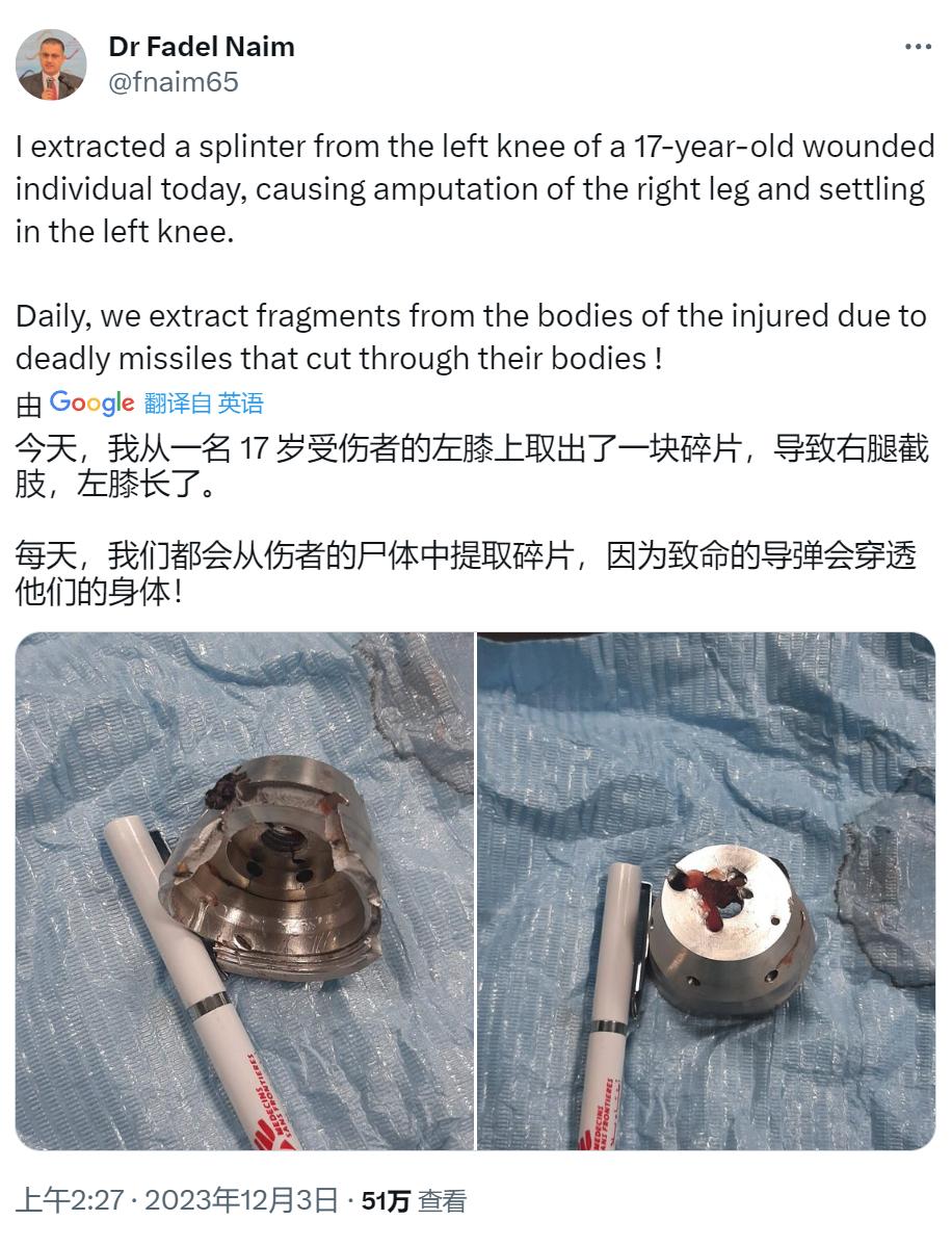 一名巴勒斯坦医生从一名17岁伤者膝盖上取出的“碎片”，这块碎片导致伤者右腿截肢，