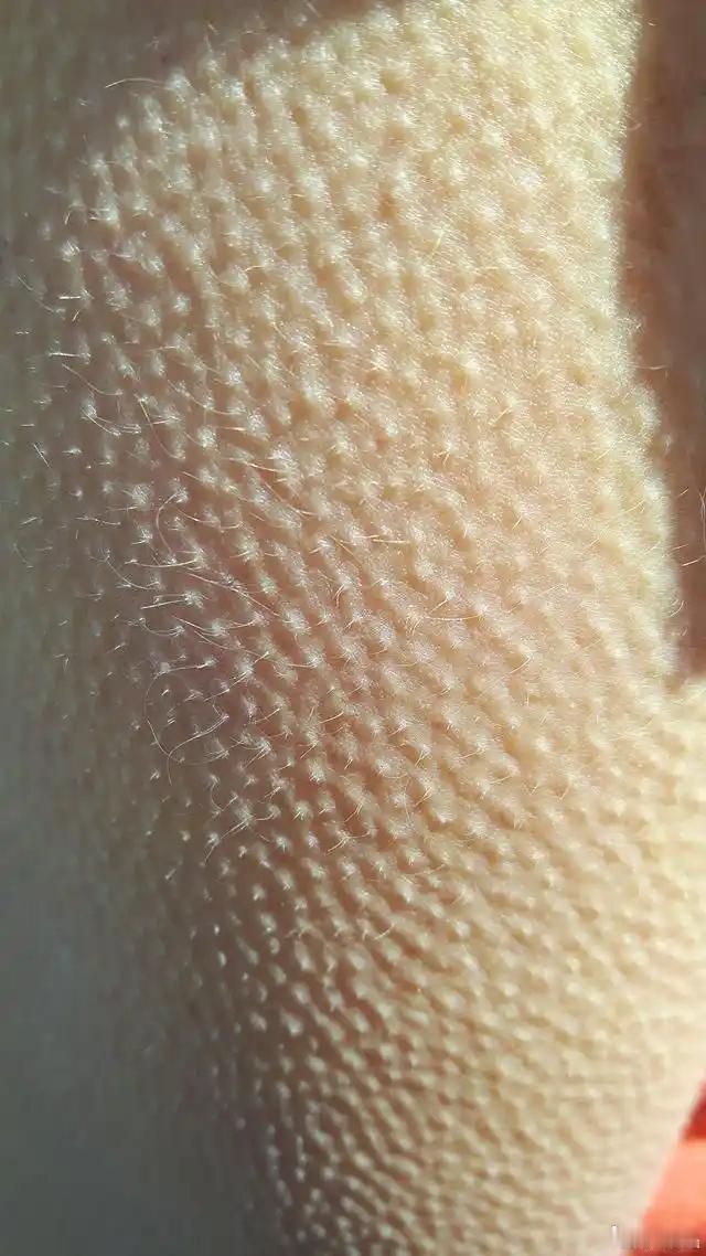 鸡皮疙瘩一般是什么情况下产生的？ 