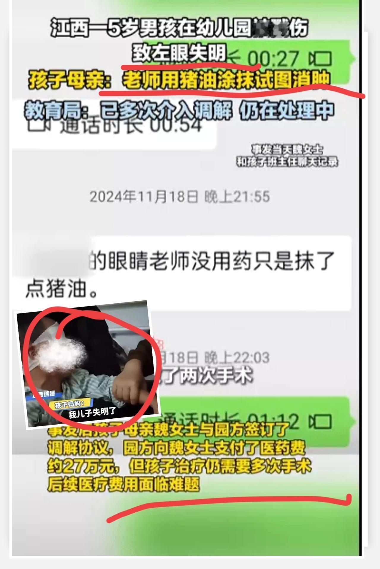 猪油敷眼？
这哪是救孩子，分明是在害孩子！
江西瑞昌这事儿真的太让人揪心了。
 