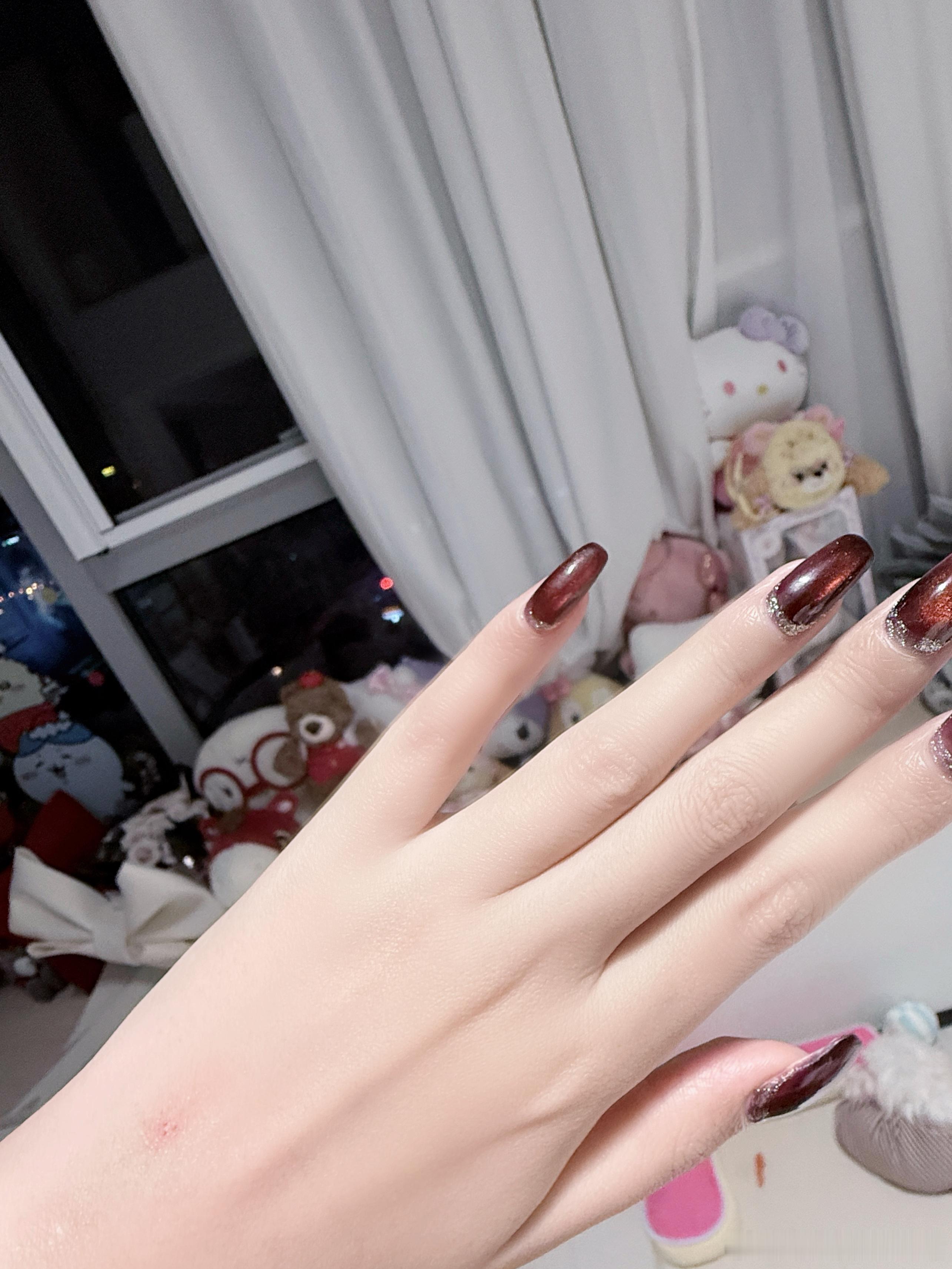 智齿发炎我们恨你【连打三天针还是张嘴困难版 