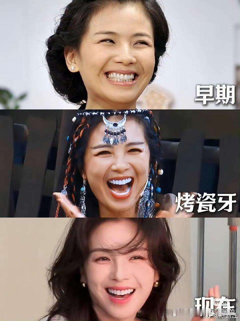 据说刘涛这一口牙花了三百万，值不值？ ​ ​​​