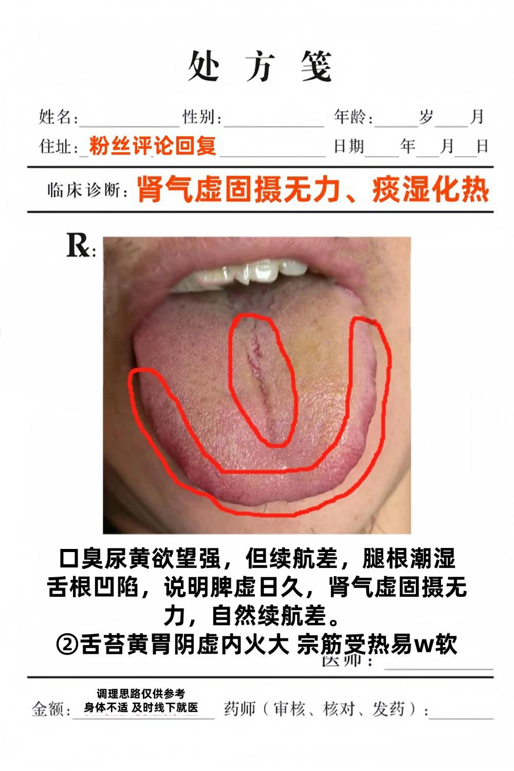 你的舌象和下面的像吗？今天比较有空，继续挑战看舌象！

想看的都可以拍了，你拍我