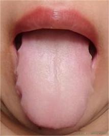 美女粉丝说自己最近身子很沉想一直在床上呆着，脸还总是浮肿，很是上愁[笑哭][笑哭