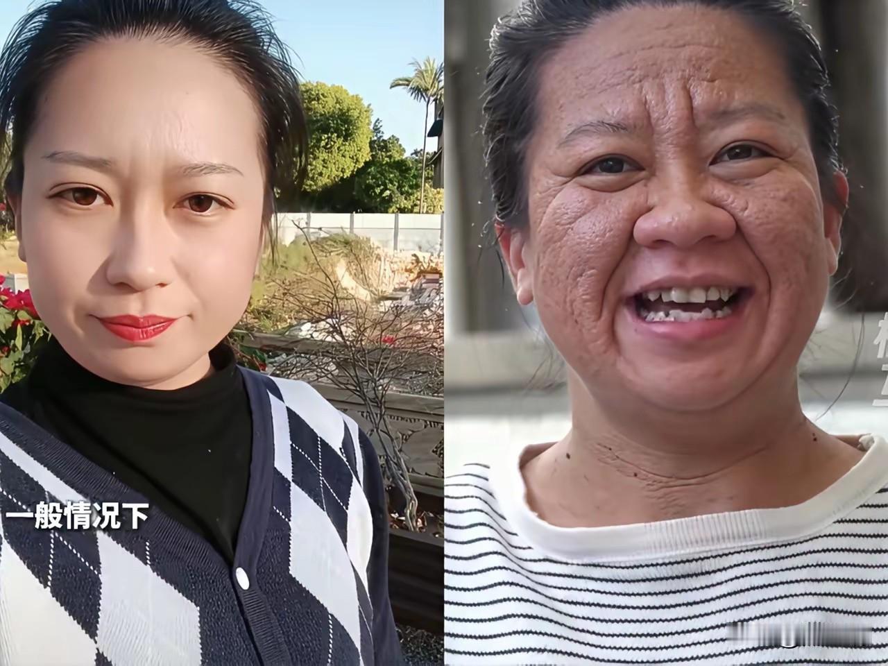 当个妈妈太不容易了，为了生孩子这个妈妈容貌都变了，皮肤黝黑，毛孔粗大，咋还多了那