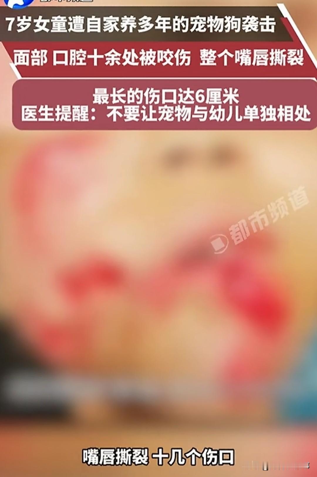 触目惊心！泉州，7岁女孩小莉。那天她在家和养了多年的宠物狗玩耍，毫无征兆地，狗突