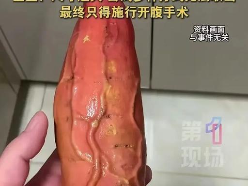 四川成都，61岁的本地男子张某，将一根尺寸极大的红薯塞进体内，硬生生把自己送进了