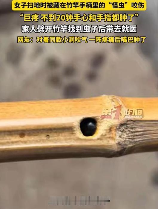 一口气，吹出了两条新闻，一条是四川雅安女子被扫把里窜出的虫子蛰肿了手,另一条是某