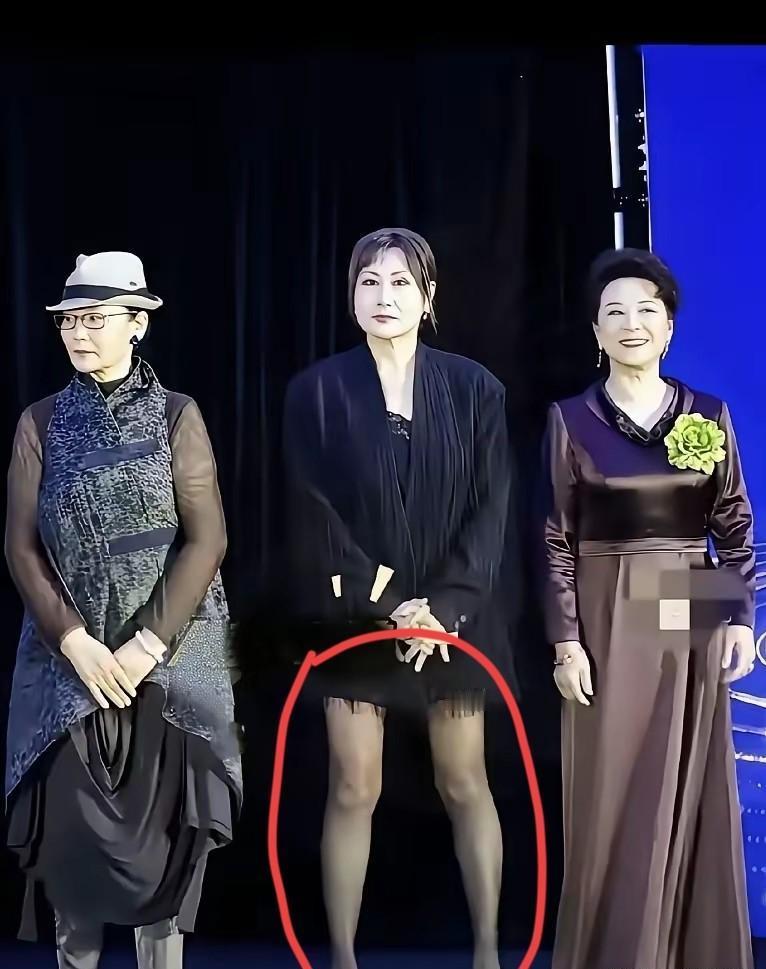 62岁张凯丽被骂上热搜的“恐怖”站姿，可能是造型师最成功的陷阱。
那张刷屏的活动