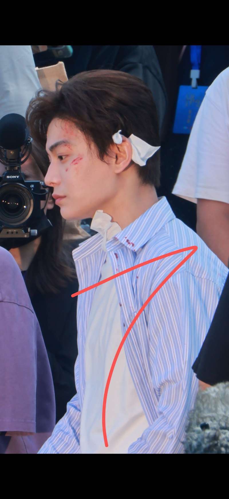 两眼没看伤的更厉害了 受不了 ​​​